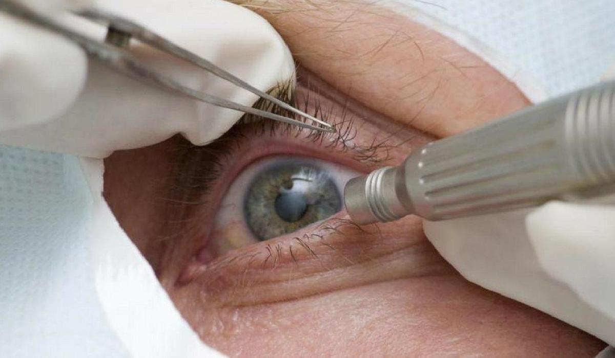 Pandemia faz cair detecção precoce de glaucoma